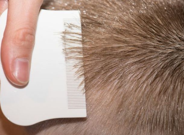 Ψείρες τριχωτού κεφαλής