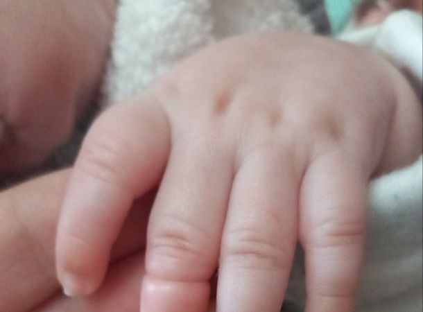 Ενδιαφέρον περιστατικό